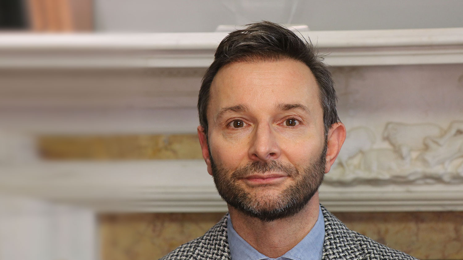 Jeremy Langmead Hair Transplant